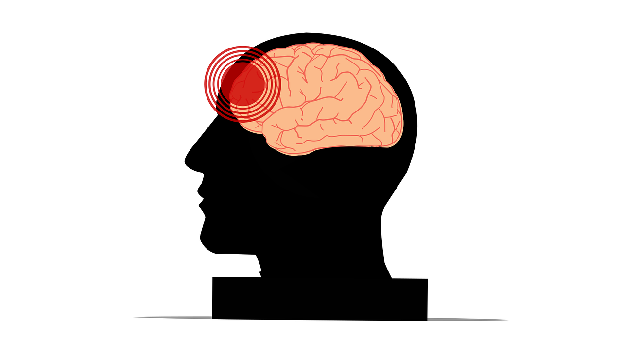 Gehirnverletzungen Gehirnerschütterung